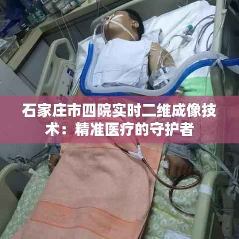 石家庄市四院实时二维成像技术：精准医疗的守护者