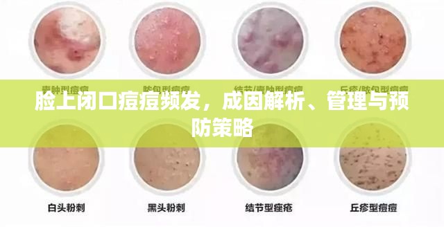 脸上闭口痘痘频发，成因解析、管理与预防策略