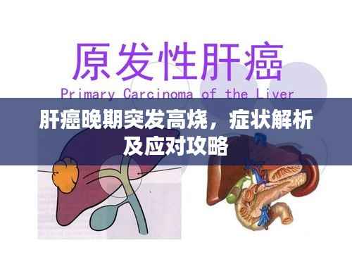 肝癌晚期突发高烧,症状解析及应对攻略
