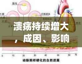 溃疡持续增大，成因、影响及有效治疗策略