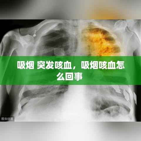 吸烟 突发咳血，吸烟咳血怎么回事 