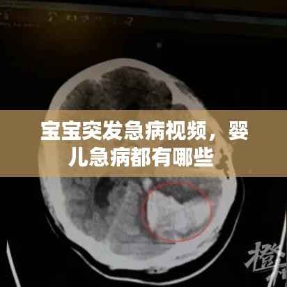 宝宝突发急病视频，婴儿急病都有哪些 