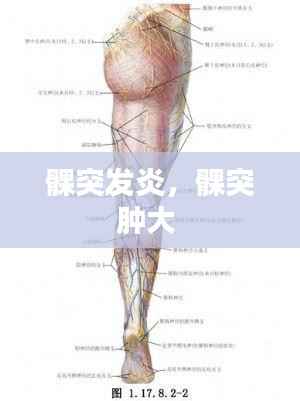髁突发炎，髁突肿大 