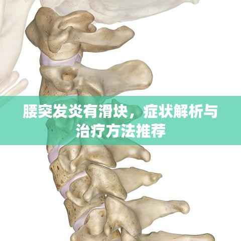 腰突发炎有滑块，症状解析与治疗方法推荐
