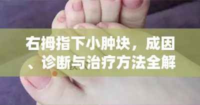 右拇指下小肿块,成因、诊断与治疗方法全解析